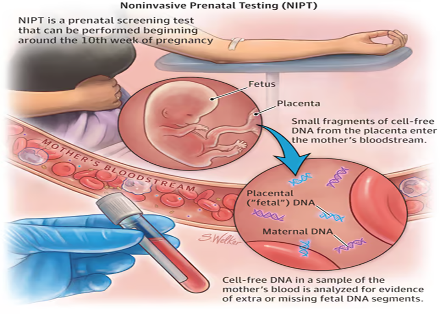 NIPT Testing Process
